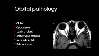 Imaging of Orbit Sep 2013   Dr Mamdouh Mahfouz In Arabic