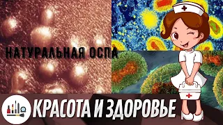 Натуральная оспа