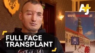 Man With Full Face Transplant Eating Again