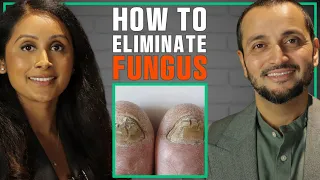 Learn How To Eliminate Fungal Overgrowth