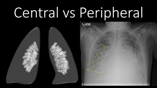 Chest Radiology - Location