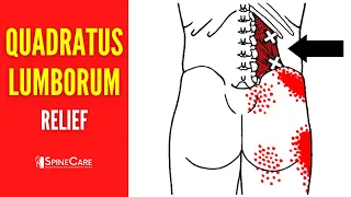 How to Fix Quadratus Lumborum Pain FOR GOOD