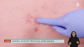 Casos e internações por herpes-zóster aumentam significativamente em todo o Brasil nos últimos anos