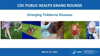Emerging Tickborne Diseases