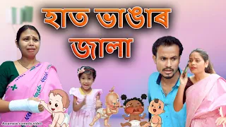 হাত ভাঙাৰ  জালা | Assamese comedy video | Assamese funny video