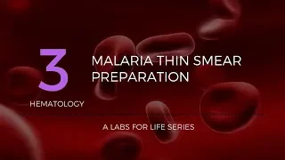 Malaria Thin Smear Preparation