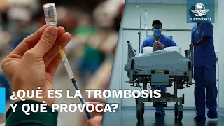 Esto debes saber sobre la Trombosis, enfermedad con la que ligan la vacuna antiCovid de AstraZeneca