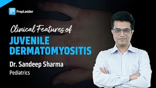 "Clinical Features of Juvenile Dermatomyositis" by Dr. Sandeep Sharma