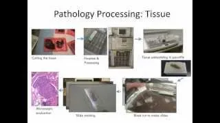 GRACEcast-127_CA-101_Intro to Molecular Pathology with Dr. Aisner, Part 1: What Do the Terms Mean?