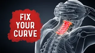 How To Fix Your Neck Posture/Curvature for Neck Pain Relief? – Dr. Berg