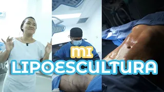 ASÍ FUE MI LIPOESCULTURA👨🏻‍⚕️🏩 | Sharick Logatto