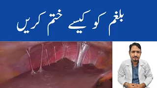 How To Get Rid Of Respiratory Mucus (Phlegm) Urdu Hind - Balgam Khatam Karne Ka Tarika - Irfan Azeem