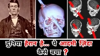 इस आदमी के दिमाग  से 4 फुट लम्बी लोहे की ROD गुज़री. ऐसे ये ज़िंदा बचा (Phineas Gage Case Study)