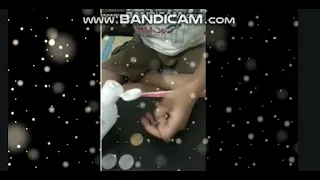CLEANING OF COINS FROM SANITIZER