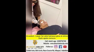 Laser for skin fairness glow shine dark spot remove at Dr.RACHI’S skin city . Q switch laser