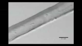 Caught on tape: Muscle stem cells captured on video