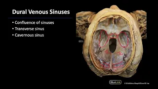 Dural Venous Sinus - Dissection Supplement