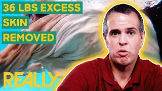 Man Goes Through Emotional Transformation After 479-lb Weight Loss | My Extreme Excess Skin