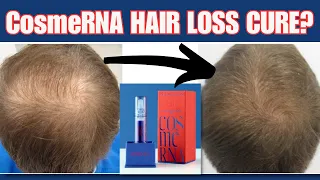 CosmeRNA Will Be The BEST New Hair Loss Treatment- Dr. Sergio Vaño