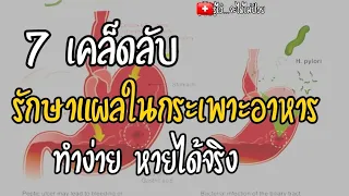 🎯 7 เคล็ดลับรักษาแผลในกระเพาะอาหาร แบบง่ายๆหายได้จริง|รู้ไว้จะได้ไม่ป่วย