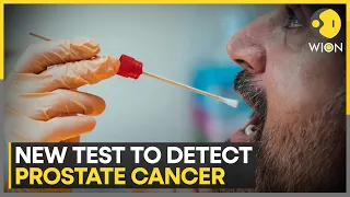 Scientists develop low-cost spit test to detect Prostate Cancer | World News | WION