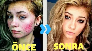 Kadınların Makyaj Öncesi ve Sonrası Halleri #makeup