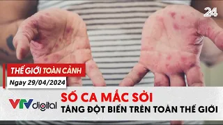 Thế giới toàn cảnh 29/04: Số ca mắc sởi tăng đột biến trên toàn thế giới | VTV24