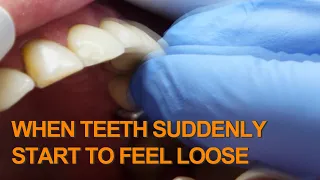 loose teeth, why is it happening...?