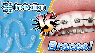 Braces Vs. Invisalign [What's Best For You?] | Premier Orthodontics