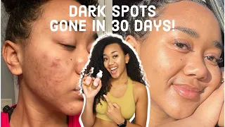 MY SKINCARE ROUTINE FOR DARK SPOTS, SCARS, AND HYPERPIGMENTATION! | Simple, natural, and affordable