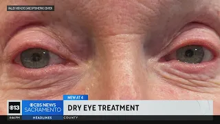 Recenly approved FDA technique proving good treatment for dry eyes