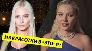 ЧТО СЛУЧИЛОСЬ С ЛИЦОМ АЛЁНЫ ШИШКОВОЙ???