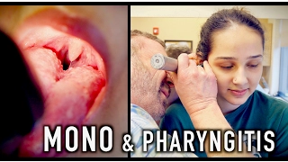 MONO & PHARYNGITIS (Crazy Story) | Dr. Paul