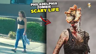 Faces of Philadelphia | Look what happened to this woman's face | Streets of Kensington Philadelphia