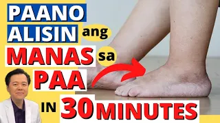 Paano Alisin ang Manas sa Paa in 30 minutes - Payo ni Doc Willie Ong #1442