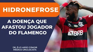 HIDRONEFROSE - CONHEÇA A DOENÇA QUE CAUSOU O AFASTAMENTO DO JOGADOR DO FLAMENTO | Dr. Élio Arão Jr