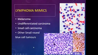 Lymph Node FNA Cytology: Approach