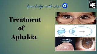 Treatment of Aphakia ophthalmology Ak khurana #knowlege with Ani 🧿