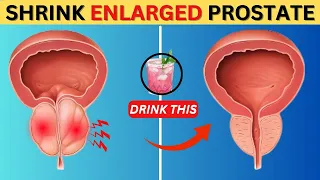 "Drink 1 CUP PER DAY To Shrink ENLARGED PROSTATE" @Drberg