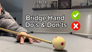 IMPROVE IN 2 MINUTES | Bridge Hand Do’s & Don’ts | 8 Ball | Michael Scerri