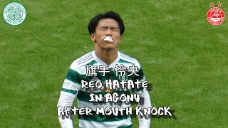 旗手 怜央 Reo Hatate in Agony After Mouth Knock -   セルティック - Celtic 2 - Aberdeen  - 31 July 2022