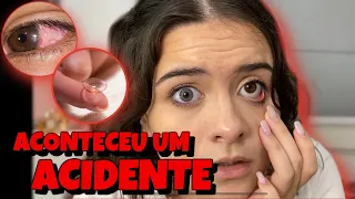 A LENTE DE CONTATO SUMIU NO MEU OLHO! 100% REAL