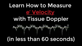 How to Measure e' Velocity with Tissue Doppler for Diastolic Dysfunction Measurement in 60 Seconds!