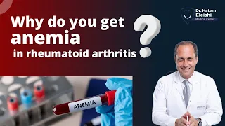 Why patients with rheumatoid arthritis get anemia. Dr. Hatem Eleishi