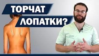 Торчат лопатки? Плечи на разном уровне? Что делать, если  ничто не помогает? | Доктор Демченко