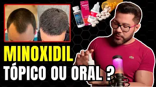 MINOXIDIL TÓPICO OU ORAL? QUAL É MELHOR?