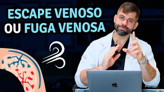 Escape Venoso ou Fuga Venosa (Disfunção Erétil) | Dr. Marco Túlio Cavalcanti