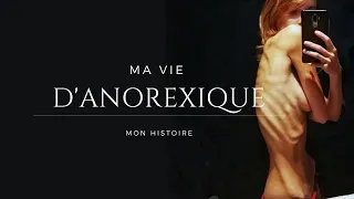 MA VIE D'ANOREXIQUE/témoignage/de la chute extrême à la guérison totale/comment s'en sortir