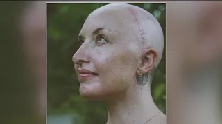 Woman with terminal brain tumor helps others