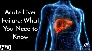 Acute Liver Failure: What You Need To Know